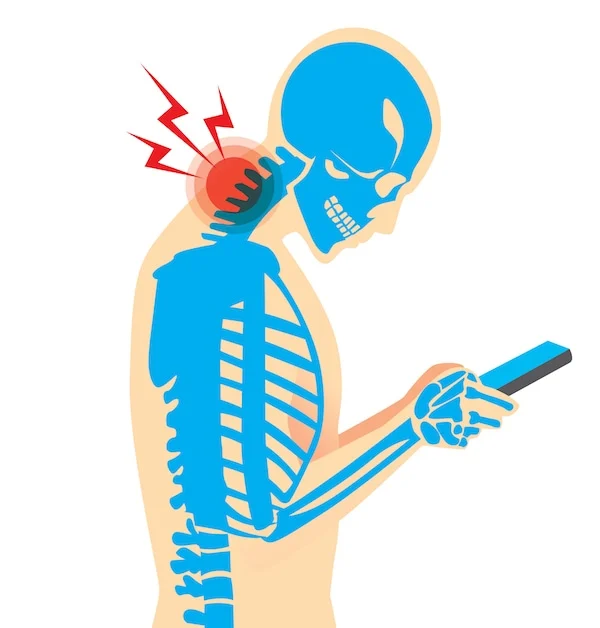 ¿Qué es y cómo evitar el síndrome de “cuello de texto” (Text neck)?.
