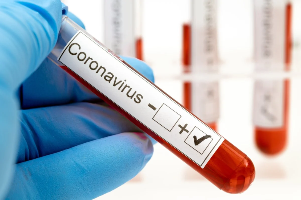 Test coronavirus